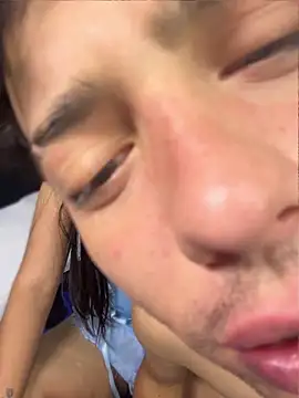 Medusa_Mgl live