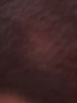 kisssssssss live